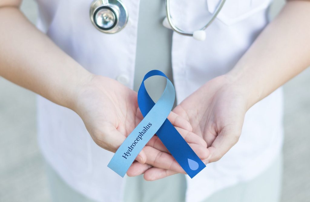 Hydrocephalus - הידרוצפלוס